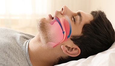 Man with animation of airway on profile